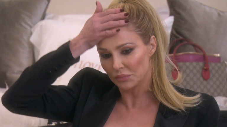 Brandi Glanville Reveals Disfigured Face: I Blame Bravo!